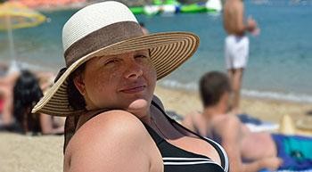Chafing Swimsuit Season